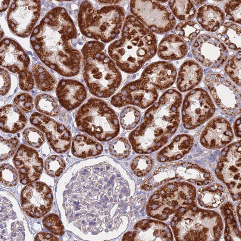 Anti-CHCHD6 Antibody