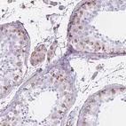 Anti-PTCD1 Antibody