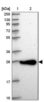 Lane 1: Marker [kDa] 250, 130, 95, 72, 55, 36, 28, 17, 10_br/_Lane 2: Human cell line RT-4