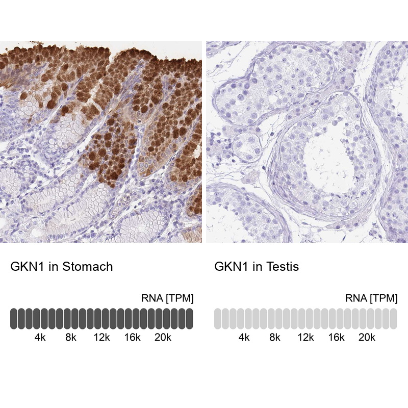 Anti-GKN1 Antibody