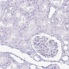 Immunohistochemical staining of human kidney shows no positivity in cells in tubules as expected.
