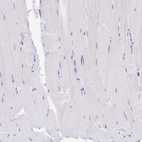Immunohistochemical staining of human skeletal muscle shows no positivity in myocytes as expected.