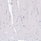 Immunohistochemical staining of human skeletal muscle shows no positivity in myocytes as expected.