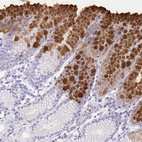 Immunohistochemical staining of human stomach shows moderate to strong positivity in mucus in glandular cells.