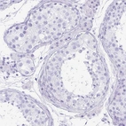 Immunohistochemical staining of human testis shows no positivity in cells in seminiferous ducts as expected.