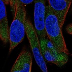 Anti-UGT3A1 Antibody