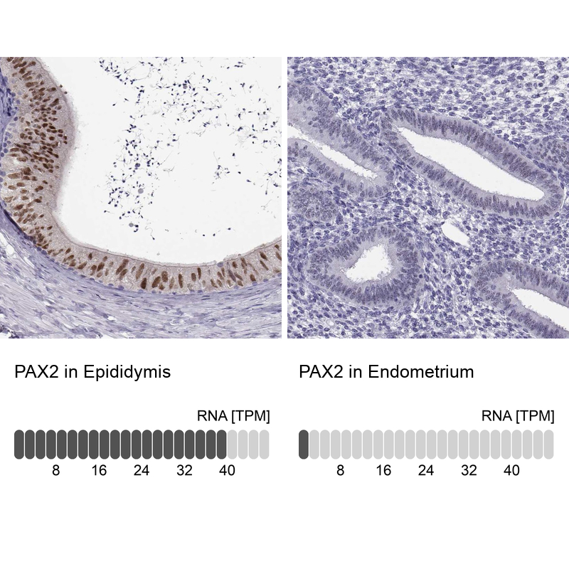 Anti-PAX2 Antibody