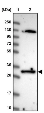 Lane 1: Marker [kDa] 250, 130, 95, 72, 55, 36, 28, 17, 10_br/_Lane 2: Human cell line RT-4