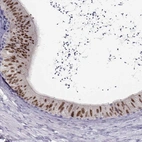 Immunohistochemical staining of human epididymis shows high expression.