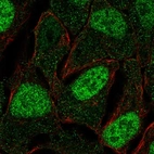 Immunofluorescent staining of human cell line RT4 shows localization to nucleoplasm.