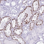 Anti-OR4F3 Antibody