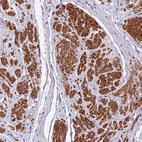Anti-PLEKHH1 Antibody