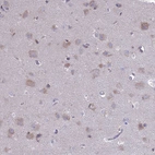 Anti-PET117 Antibody