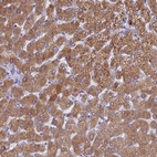 Immunohistochemical staining of human liver shows strong granular cytoplasmic positivity in hepatocytes.