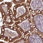 Immunohistochemical staining of human small intestine shows strong membranous positivity in glandular cells.