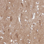 Immunohistochemical staining of human cerebral cortex shows strong cytoplasmic granular positivity in neurons.