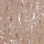 Immunohistochemical staining of human cerebral cortex shows strong cytoplasmic granular positivity in neurons.