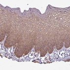 Immunohistochemical staining of human skin shows moderate cytoplasmic positivity in squamous epithelial cells.