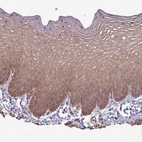 Immunohistochemical staining of human skin shows moderate cytoplasmic positivity in squamous epithelial cells.