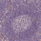 Immunohistochemical staining of human lymph node shows no positivity in germinal center cells as expected.