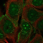 Immunofluorescent staining of human cell line HaCaT shows localization to nucleoli, cell junctions & vesicles.