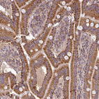 Anti-PRELID3B Antibody