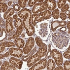Immunohistochemical staining of human kidney shows strong cytoplasmic granular positivity in cells in tubules.