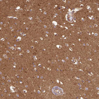 Immunohistochemical staining of human cerebral cortex shows strong cytoplasmic granular positivity in neuropil.