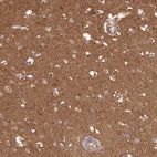 Immunohistochemical staining of human cerebral cortex shows strong cytoplasmic granular positivity in neuropil.