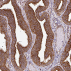 Immunohistochemical staining of human fallopian tube shows strong cytoplasmic granular positivity in glandular cells.