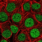 Immunofluorescent staining of human cell line MCF7 shows localization to nucleoplasm.