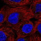Anti-ORM1 Antibody