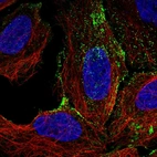 Immunofluorescent staining of human cell line U-2 OS shows localization to vesicles.