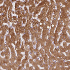 Immunohistochemical staining of human liver shows strong cytoplasmic positivity in hepatocytes.