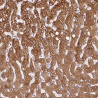 Immunohistochemical staining of human liver shows strong cytoplasmic positivity in hepatocytes.