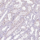 Immunohistochemical staining of human kidney shows weak cytoplasmic positivity in cells in tubules.