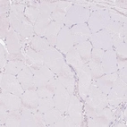 Immunohistochemical staining of human skeletal muscle shows negative cytoplasmic positivity in myocytes as expected.