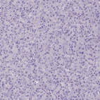 Immunohistochemical staining of human pancreas shows negative cytoplasmic positivity in exocrine glandular cells as expected.