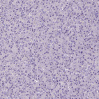 Anti-HSD11B1 Antibody