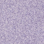 Immunohistochemical staining of human pancreas shows negative cytoplasmic positivity in exocrine glandular cells as expected.