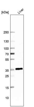 Western blot analysis in human liver tissue.