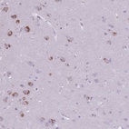 Anti-CNTNAP3 Antibody