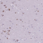 Anti-CNTNAP3 Antibody