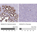 Anti-B4GALT2 Antibody