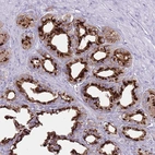 Immunohistochemical staining of human seminal vesicle shows high expression.