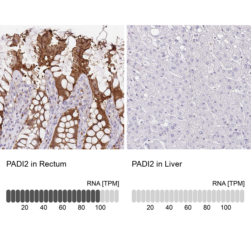 Anti-PADI2 Antibody