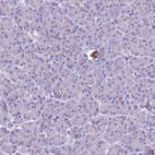 Immunohistochemical staining of human pancreas shows low expression as expected.