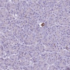 Anti-B4GALT2 Antibody