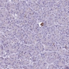 Immunohistochemical staining of human pancreas shows low expression as expected.