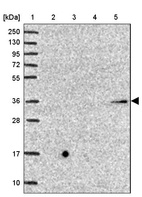 Anti-B4GALT2 Antibody